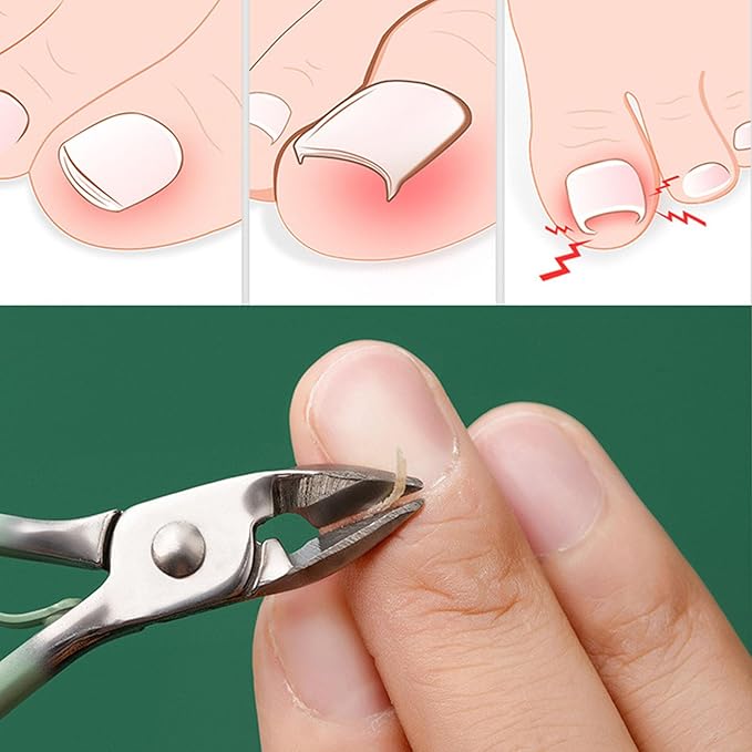 ProCare™ | La solution complète pour des soins professionnels des ongles.
