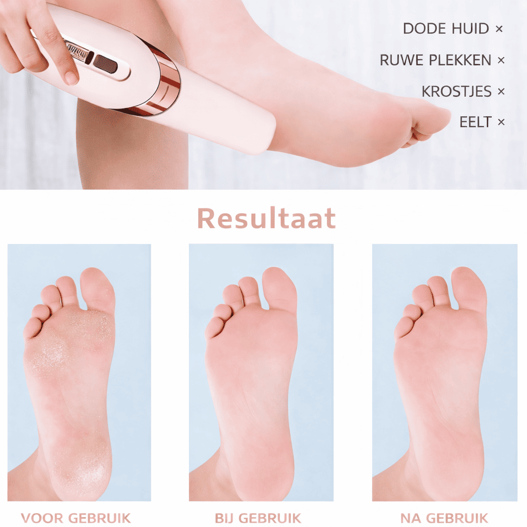PediCare™ | Prenez Soin de Vos Pieds à Domicile Facilement.