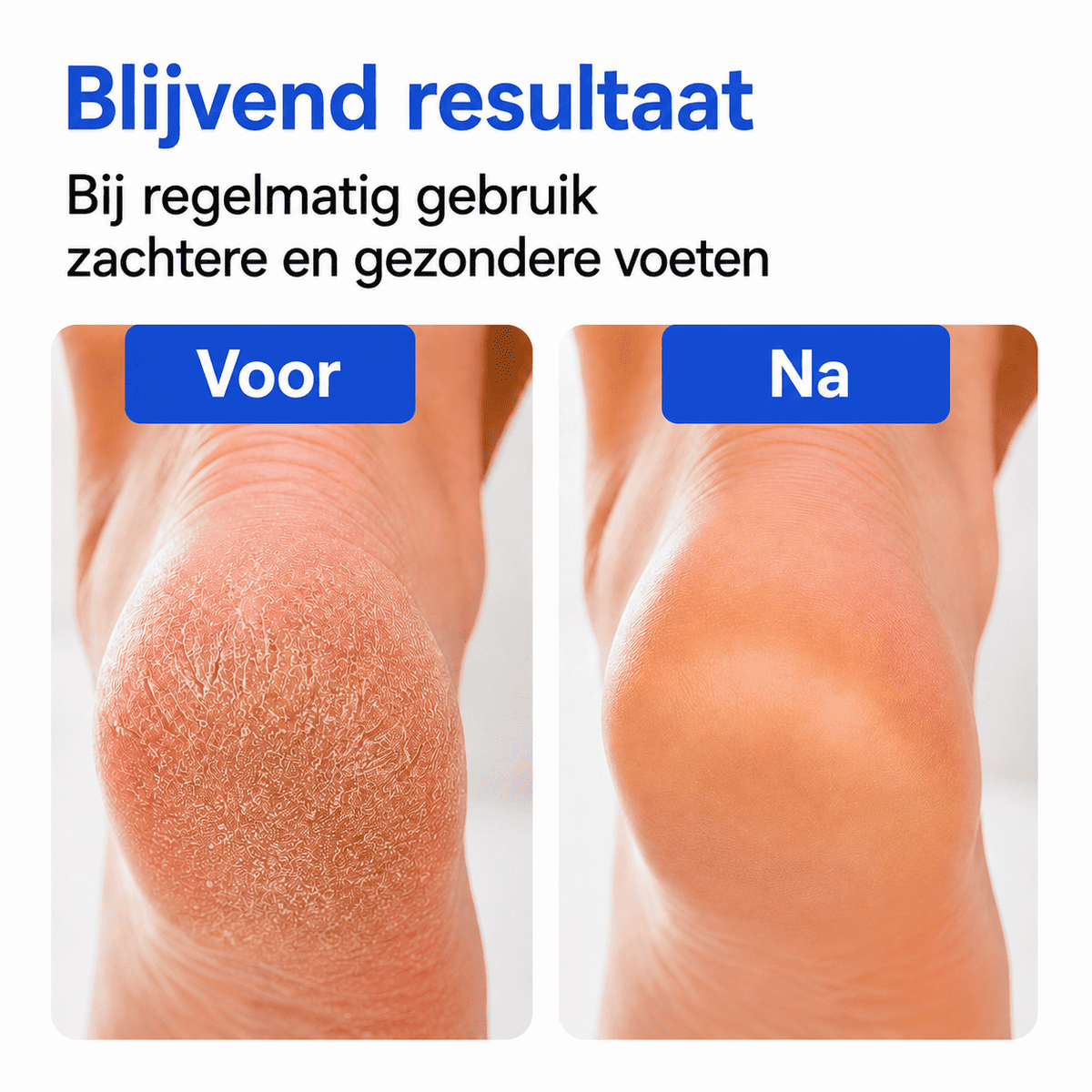 CleanStep™ | Nettoie Là Où Vos Mains Ont Du Mal à Atteindre.